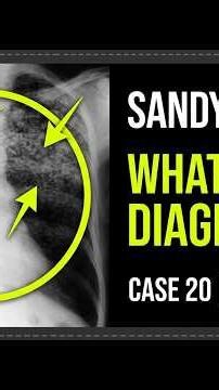 44-Year-Old Male Having A Pre-Employment Chest Radiograph | Rapid Review Case 20