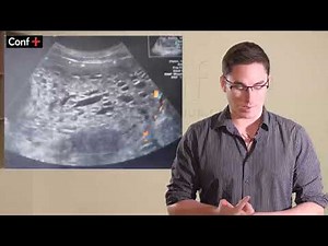 Cas de gynécologie (maladie trophoblastique)