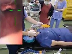 How to do Intubation | The Nursing Times