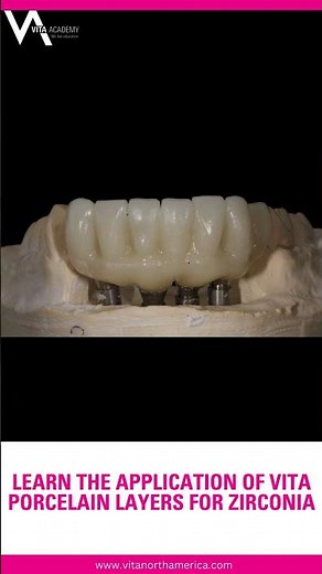 Learn the Application of VITA Porcelain Layers for Zirconia!