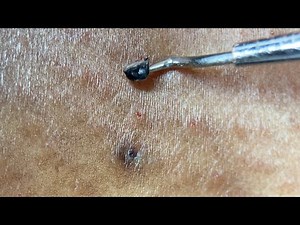 EXTRACT WITH ME PT.5!