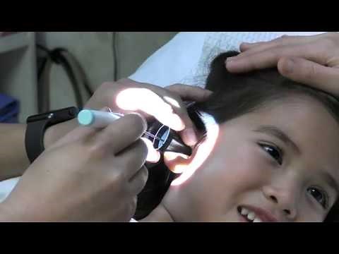 Awake Ear Tube Placement In Children