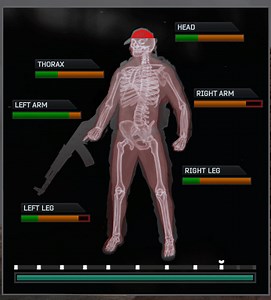EFT Health 1.1 addon - S.T.A.L.K.E.R. Anomaly mod for S.T.A.L.K.E.R.: Call of Pripyat