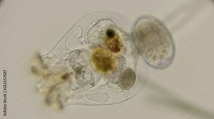 the rotifer Brachionus plicatilis with eggs, you can see all the internal organs and how they work, under the microscope