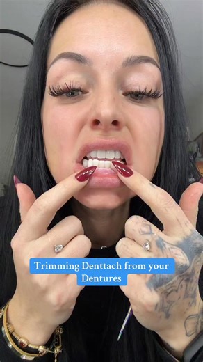 Trimming Denttach from your Dentures #dentures #toothless #To0thlessQueen #teethcare #teeth #DentureCare | Amber Warner