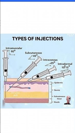 types of injections