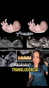 4.9K views · 51 reactions | ✨‍⚕️La importancia de la ecografia de la semana 11 -13.6 semanas #fy #parati #embarazo #post #prenatal | Servicios Médicos MJ | Facebook