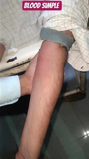 Blood Sample Kaise Liya Jata Hai? | Medical Blood Test Process #viral #drankityadavpt