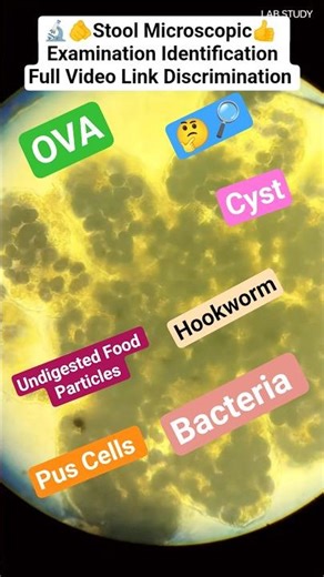 Stool examination||stool analysis||stool routine examination test #lab #labtechnician #shortvideo