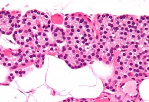 Parathyroid chief cell - Alchetron, The Free Social Encyclopedia