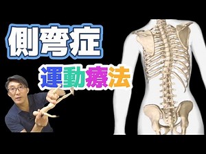 How to treat scoliosis: Mechanism and exercise therapy
