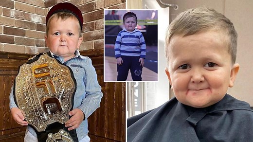 How old is Hasbulla? His age, nationality and condition explained