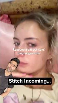 You Can Get Ringworm From Pets