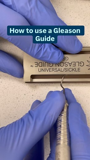 Matthew Bradley, RDH | The @pdtdental Gleason Guide was a lifesaver for me sharpening extremely dull instruments. The hardness thing about sharpening is getting... | Instagram