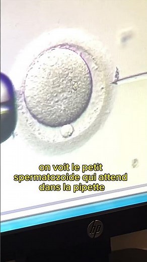 J’assiste à une Fécondation In Vitro (FIV) en direct !