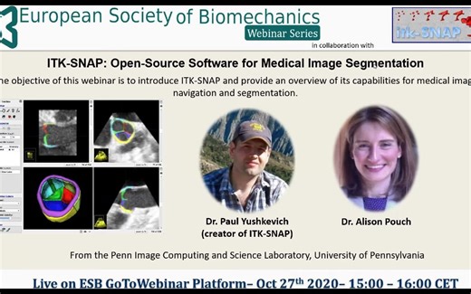 ITK Snap open source software for medical image processing