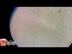Trichomonas hominis - Coproparasitologico
