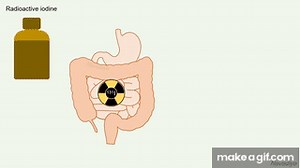Radioactive Iodine (Iodine-131) on Make a GIF