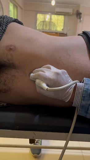 Very simple demonstration of the gastric U/S on a volunteer. Register in our recorded online course to learn so many critical care U/S tricks which will change your way of management and boost your ICU skills. We are continuously upgrading our courses., so you will expect new lectures to be added to your course from time to time. Attention please, now the complete Lower Limb arterial and venous Doppler course and abdominal U/S course are added to our recorded critical care U/S from basic to adva