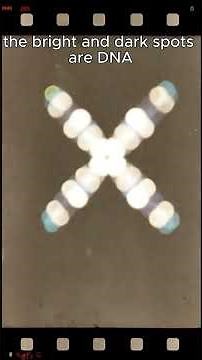 Discovery of DNA by Rosalind Franklin