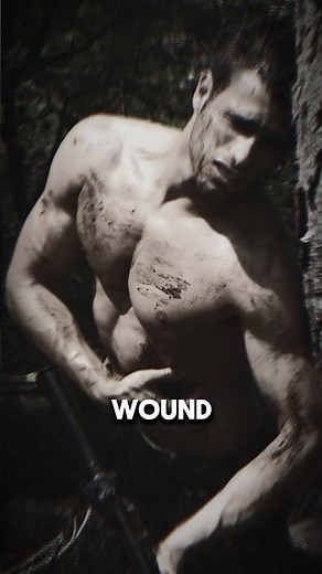 Why Did U.S. Soldiers Use Maggots for Wounds 🤢