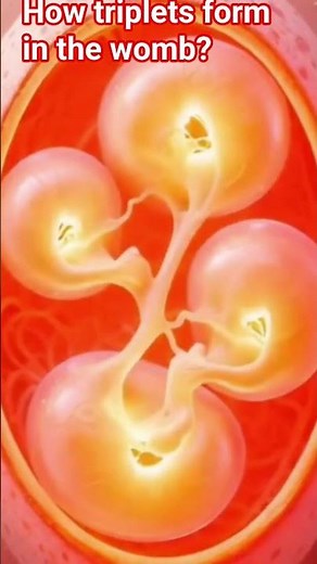 How triplets are form in the Womb?