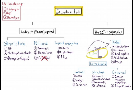 Dx Schema – Jaundice