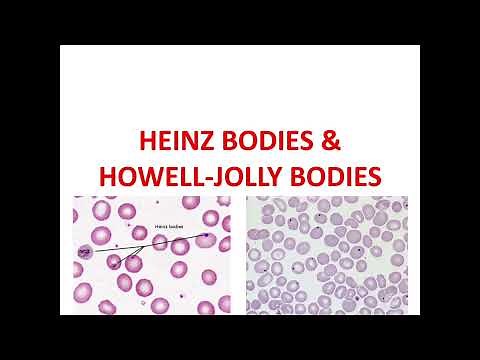 HEINZ BODIES and HOWELL-JOLLY BODIES