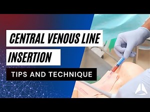 Central Venous Catheter (CVC) Demonstration | #anesthesiology #anesthesia #anaesthesia #cvc