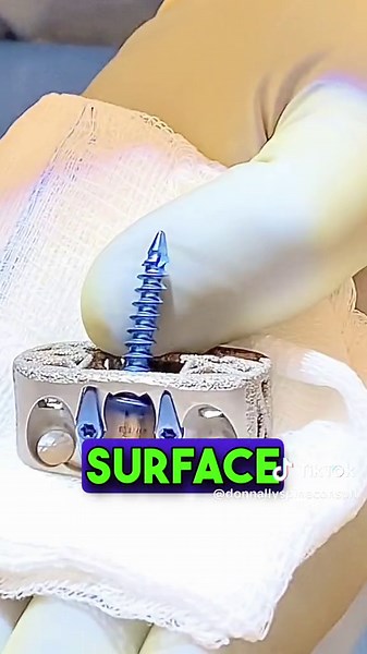 Innovative Spinal Fusion Technology for Effective Surgeries