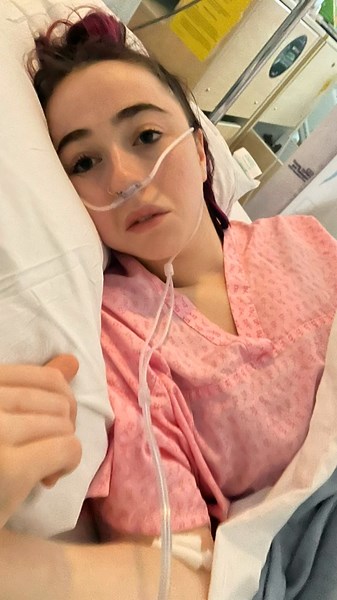 Understanding Health Trauma from Seizures and Dystonia