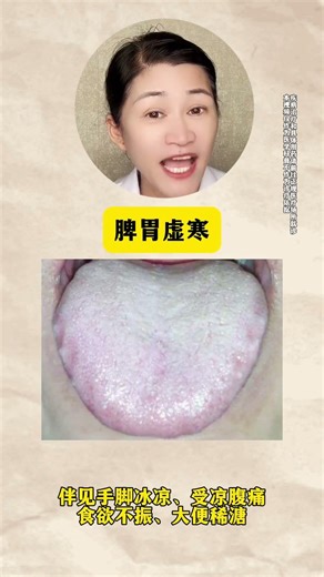 Unlock the Secrets of Chinese Medicine: 7 Tongue Coatings Explained
