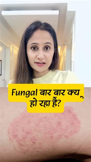 Fungal infection prevention and treatment!Daad khaj |jock itch treatment