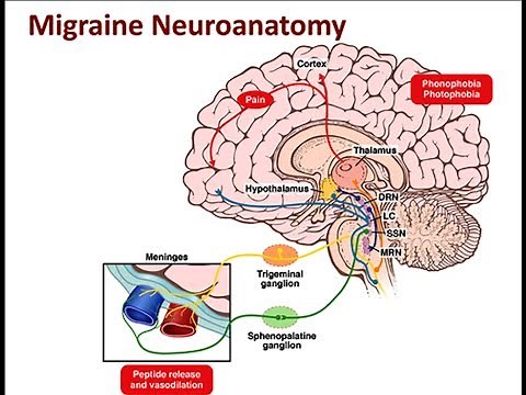 Migraine [Lecture] [Neurology]