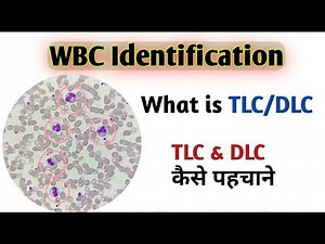wbc count microscope