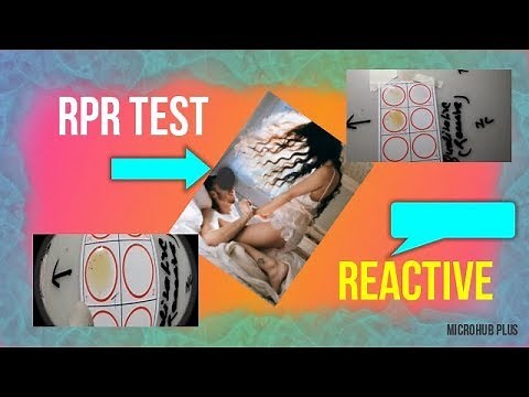RPR test reactive