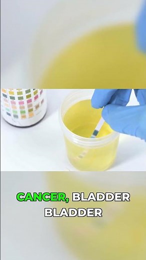 Your Doctor Will Run These Tests for Prostate Pain #health #diagnosis