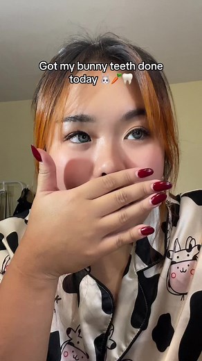 Bunny Teeth Transformation: My Dental Experience