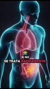 PERITONITIS: El Dolor Abdominal que Puede Ser Mortal
