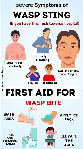 is wasp sting dangerous??? when to go to hospital.