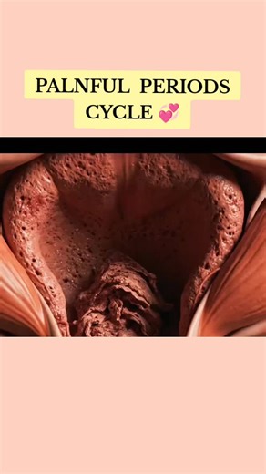 Painful Periods Begin 💞 #periods #process #fyp #newyarkcity🇺🇸 #