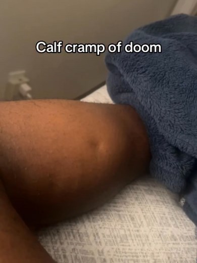 You weren't doing anything wrong. Your calf simply decided it was done with you. A calf cramp is your gastrocnemius muscle throwing a full tantrum — contracting so hard and so fast that it turns into a visible, writhing knot under the skin with absolutely zero regard for what you had planned. The causes? Could be dehydration. Could be low magnesium. Could be you slept weird. Could be your calf is just built different and deeply unhinged. The pain is immediate, intense, and deeply personal. And t