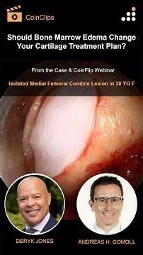 Isolated Medial Femoral Condyle Lesion in 38F