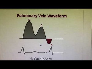 Pulmonary vein waveform