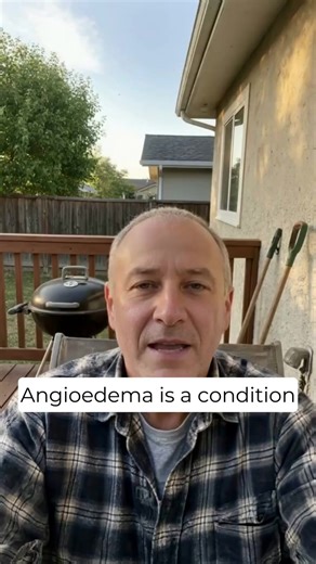 Angioedema can appear without warning—and without an obvious cause.Backed by insights from medical research, this guide reveals key facts about identifying and managing angioedema.Discover how early knowledge and the right support can help you control swelling episodes before they escalate. | Tip For Heath