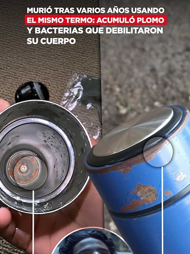 Impacto del plomo en la salud: un caso fatal