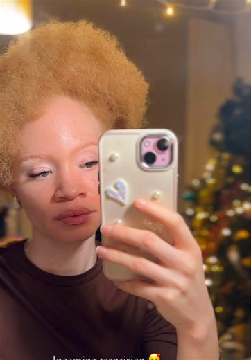 Happy Holidays 🤗 #fyppppppppppppppppppppppp #albinism #blackgirls #blackcommunity #albino