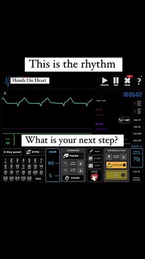 AHA 2020 ACLS. Non Shockable Rhythms: PEA (Pulseless Electrical Activity) and Asystole. Keep CPR and give epinephrine 1mg IV every 4min. #acls #ahaacls #nurselife #nursesnyc #cardiacarrest #ekg #ecg #statenisland #arrhythmia #cardiacarrhythmia #cpr #medicalstudent #pea #asystole #epinephrine