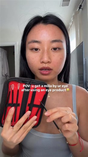 ALLIE CHEN on Instagram: "months later and the milia is STILL here..im annoyed #relateable #milia #acneproneskin #acneskincare"