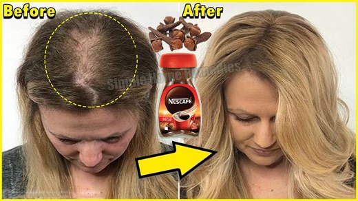 Add These to your shampoo and your hair will grow 2 times faster #haircare #beauty | Simple Home Remedies